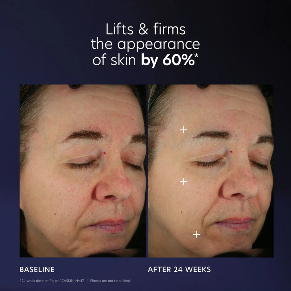 PCA SKIN Pro-Max | Age Renewal Suero antienvejecimiento avanzado con tecnología de microfactores de crecimiento 1 oz
